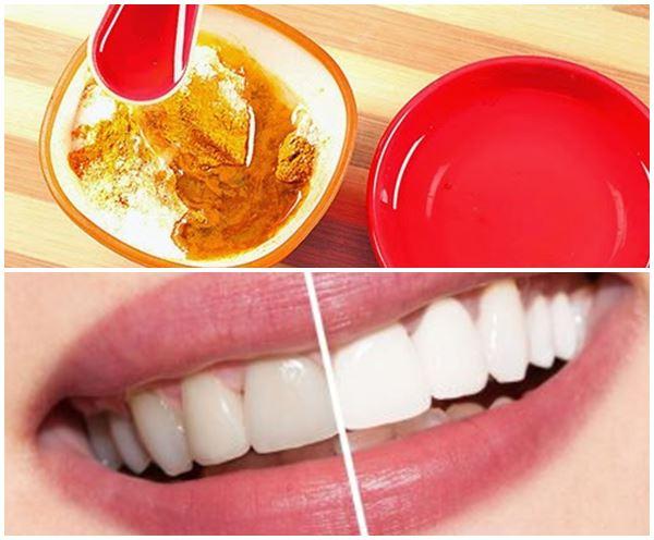 Khi kết hợp cả muối và tinh bột nghệ, sẽ không chỉ làm cho hàm răng trắng sáng mà còn giúp răng chắc khỏe mỗi ngày