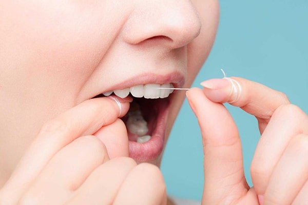 Chỉ nha khoa là gì?