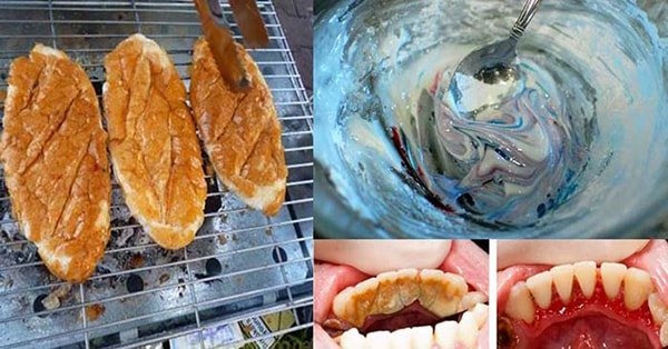Răng trắng bóng trong 5 phút chỉ với bánh mì và kem đánh răng