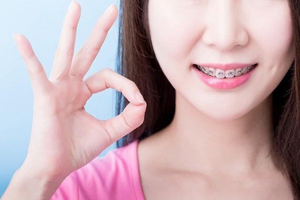 Xác định theo độ tuổi để niềng răng