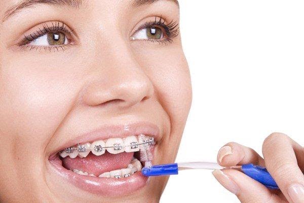 Vệ sinh đều đặn và đúng cách để có một bộ răng mạnh khỏe