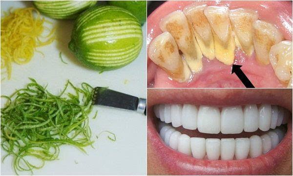 Cách làm trắng răng bằng chanh hiệu quả tại nhà thì bạn chẳng phải đi đâu xa cho tốn kém